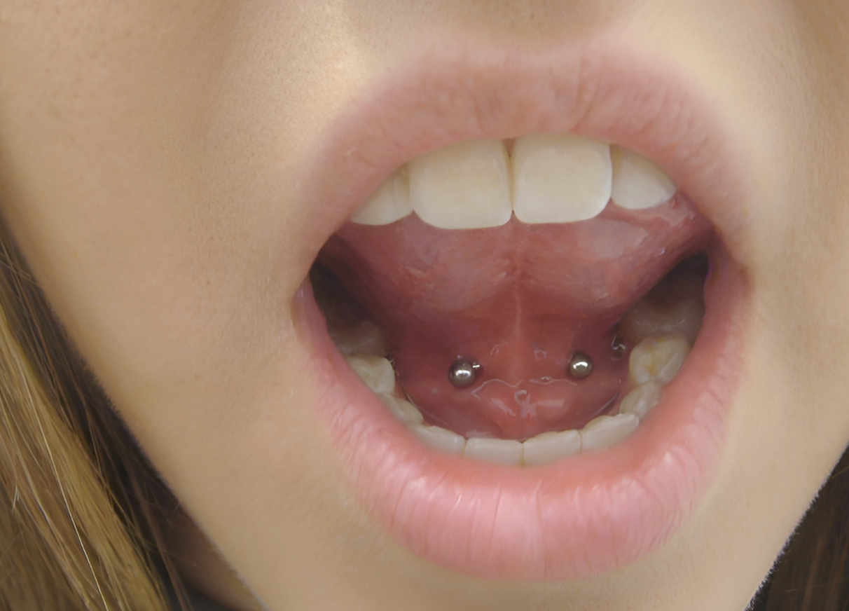 Tongue Frenulum (Lingual) Piercing