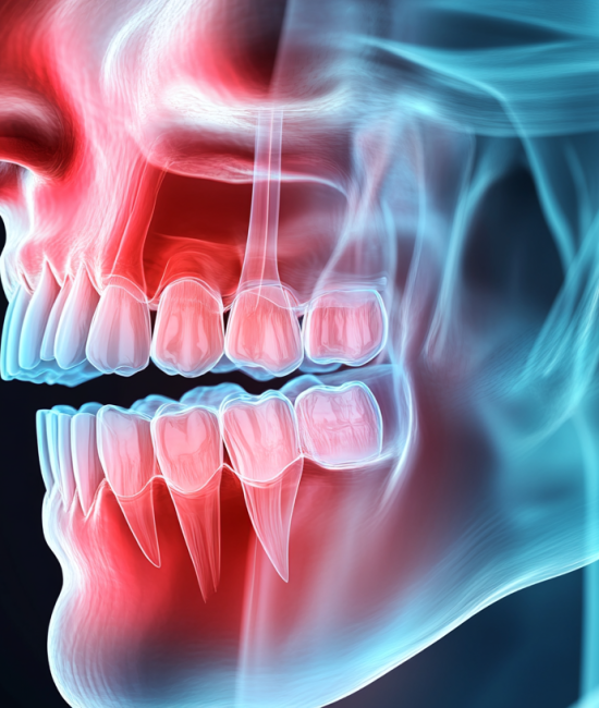 How to Choose the Right Oral Surgeon for Wisdom Teeth Removal