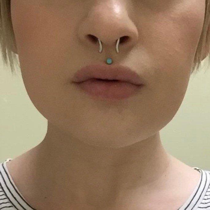 Septum_Retainer