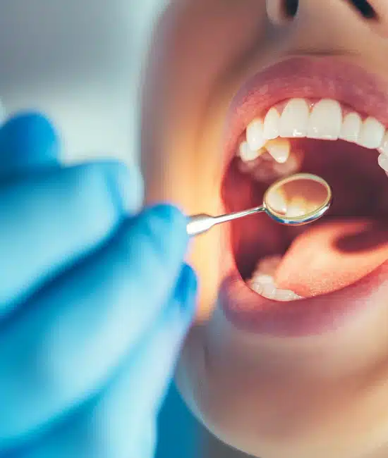 Your Guide to Top-Notch Dental Care in Fort Pierce