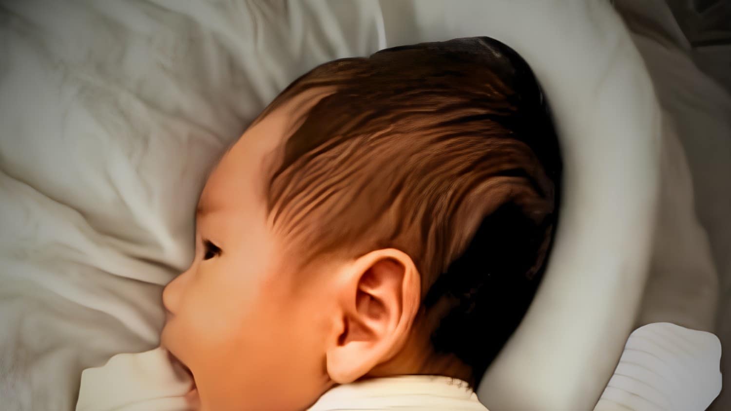 Conehead Baby Head Rounding